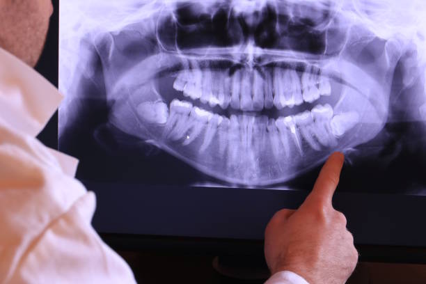 Best Emergency Treatment for Dental Infections or Abscesses in Cordova, AK
