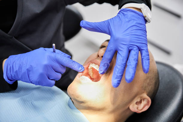Best Emergency Treatment for Dental Infections or Abscesses in Cordova, AK